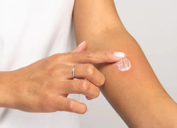 Patch Test: Why Is It Important?